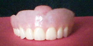 dentures raleigh nc partials