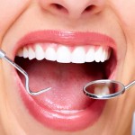 Facts About Cavities